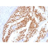 Immunohistochemistry - Anti-FOXA1 Antibody [FOXA1/1516] (A248865) - Antibodies.com