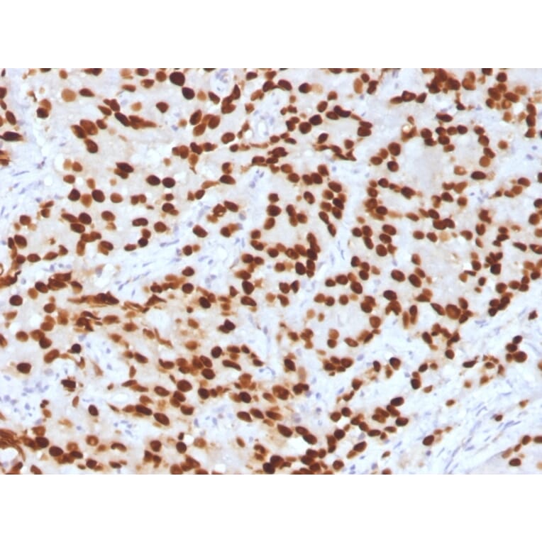 Immunohistochemistry - Anti-FOXA1 Antibody [FOXA1/1516] (A248865) - Antibodies.com