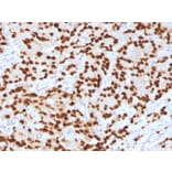 Immunohistochemistry - Anti-FOXA1 Antibody [FOXA1/1516] (A248865) - Antibodies.com