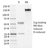 SDS-PAGE - Anti-FOXA1 Antibody [FOXA1/1516] (A248865) - Antibodies.com