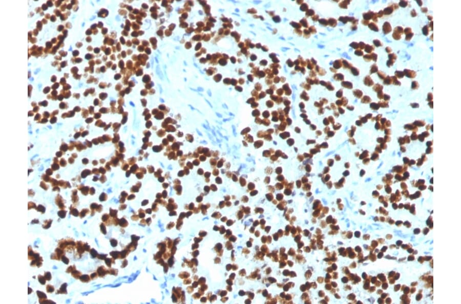 Immunohistochemistry - Anti-FOXA1 Antibody [FOXA1/1518] (A248866) - Antibodies.com