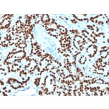Immunohistochemistry - Anti-FOXA1 Antibody [FOXA1/1518] (A248866) - Antibodies.com