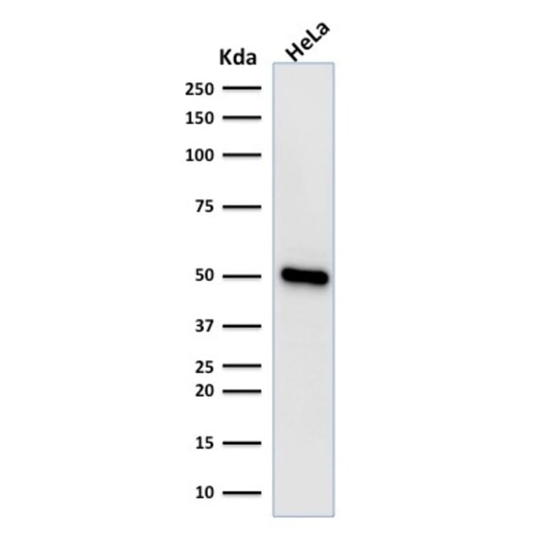 Western Blot - Anti-FOXA1 Antibody [FOXA1/1518] (A248866) - Antibodies.com