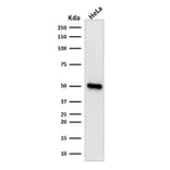 Western Blot - Anti-FOXA1 Antibody [FOXA1/1518] (A248866) - Antibodies.com