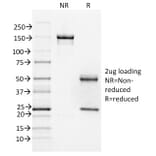 SDS-PAGE - Anti-FOXA1 Antibody [FOXA1/1518] (A248866) - Antibodies.com