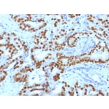 Immunohistochemistry - Anti-FOXA1 Antibody [FOXA1/1519] (A248867) - Antibodies.com