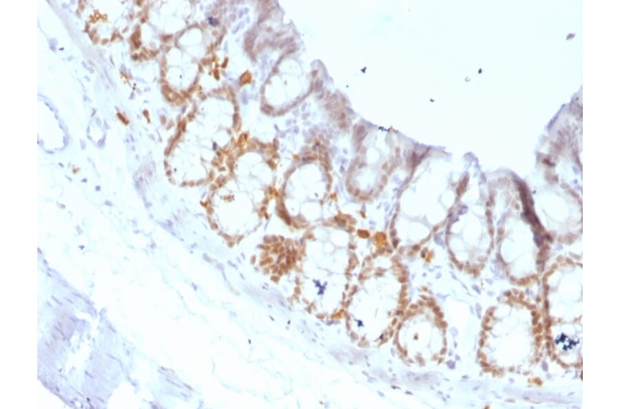 Immunohistochemistry - Anti-FOXA1 Antibody [FOXA1/1519] (A248867) - Antibodies.com
