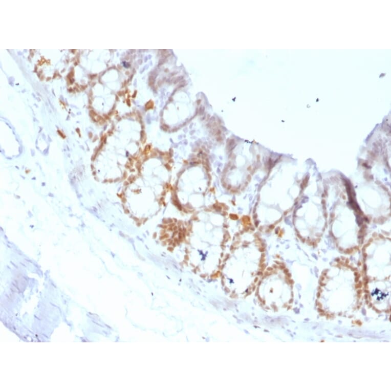 Immunohistochemistry - Anti-FOXA1 Antibody [FOXA1/1519] (A248867) - Antibodies.com