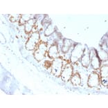 Immunohistochemistry - Anti-FOXA1 Antibody [FOXA1/1519] (A248867) - Antibodies.com