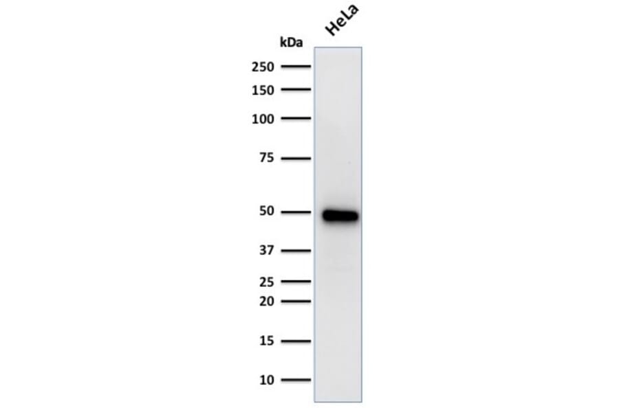 Western Blot - Anti-FOXA1 Antibody [FOXA1/1519] (A248867) - Antibodies.com