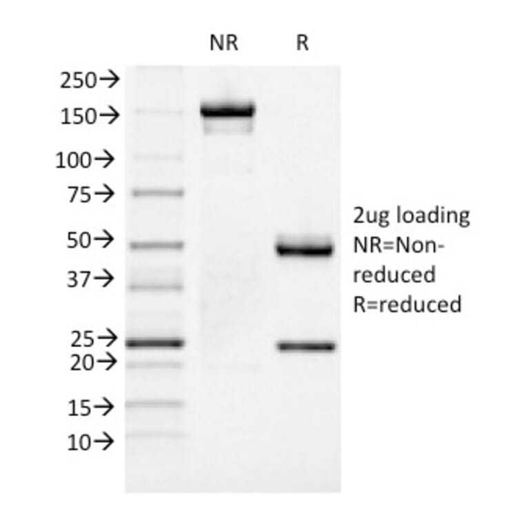 SDS-PAGE - Anti-FOXA1 Antibody [FOXA1/1519] (A248867) - Antibodies.com