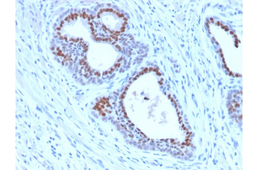 Immunohistochemistry - Anti-FOXA1 Antibody [FOXA1/2230R] (A248868) - Antibodies.com