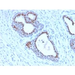Immunohistochemistry - Anti-FOXA1 Antibody [FOXA1/2230R] (A248868) - Antibodies.com