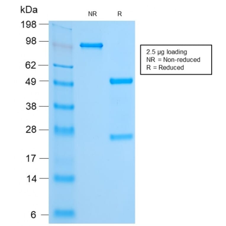 SDS-PAGE - Anti-FOXA1 Antibody [FOXA1/2230R] (A248868) - Antibodies.com