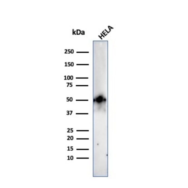 Western Blot - Anti-FOXA1 Antibody [FOXA1/2230R] (A248868) - Antibodies.com