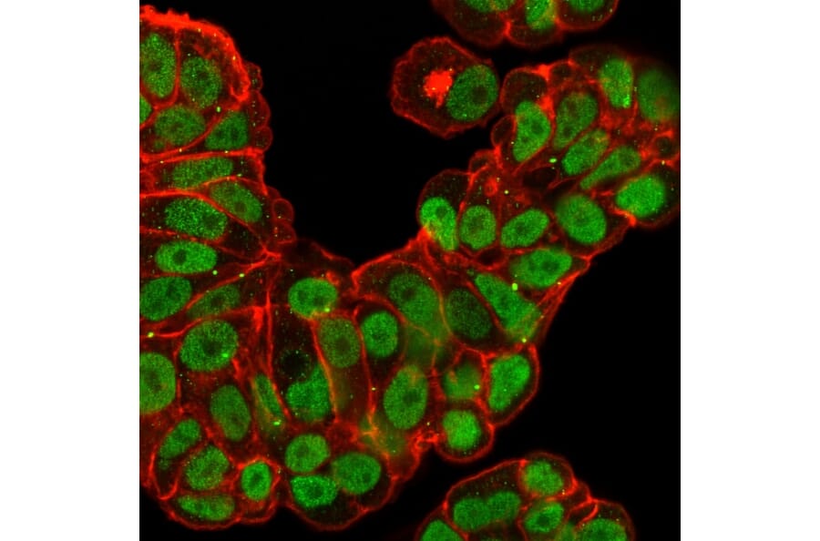 Immunofluorescence - Anti-FOXA1 Antibody [FOXA1/2230R] (A248868) - Antibodies.com