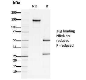 SDS-PAGE - Anti-APC Antibody [ALi 12-28] (A248868) - Antibodies.com