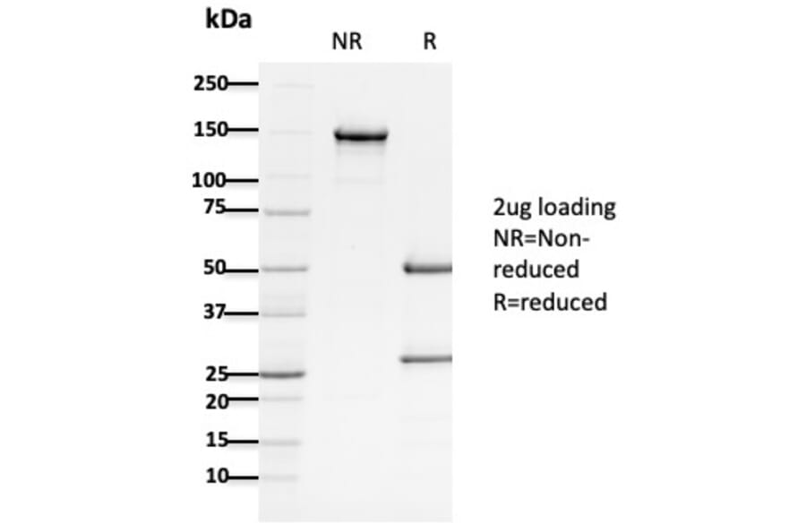 SDS-PAGE - Anti-APC Antibody [ALi 12-28] (A248868) - Antibodies.com