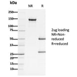 SDS-PAGE - Anti-APC Antibody [ALi 12-28] (A248868) - Antibodies.com