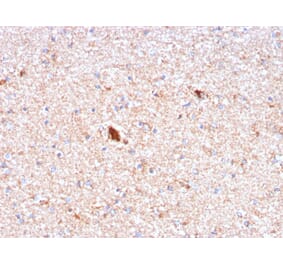 Immunohistochemistry - Anti-Serum Amyloid P Antibody [APCS/3240] (A248870) - Antibodies.com