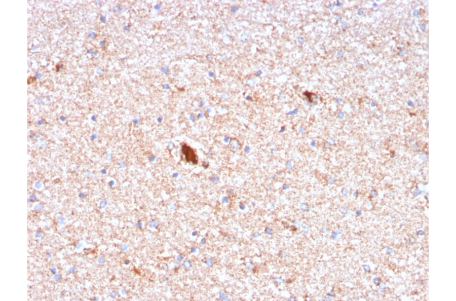 Immunohistochemistry - Anti-Serum Amyloid P Antibody [APCS/3240] (A248870) - Antibodies.com