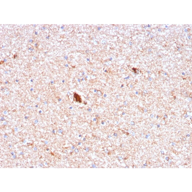 Immunohistochemistry - Anti-Serum Amyloid P Antibody [APCS/3240] (A248870) - Antibodies.com
