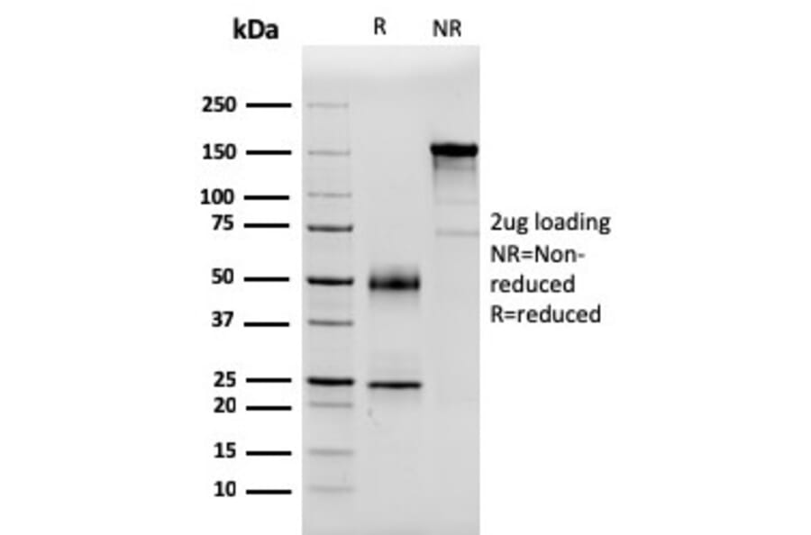 SDS-PAGE - Anti-Serum Amyloid P Antibody [APCS/3240] (A248870) - Antibodies.com