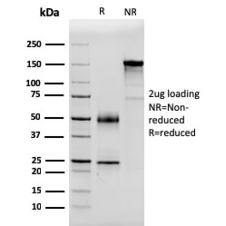 SDS-PAGE - Anti-Serum Amyloid P Antibody [APCS/3240] (A248870) - Antibodies.com