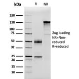 SDS-PAGE - Anti-Serum Amyloid P Antibody [APCS/3240] (A248870) - Antibodies.com