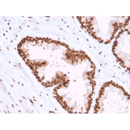 Immunohistochemistry - Anti-APE1 Antibody [CPTC-APEX1-2] (A248871) - Antibodies.com