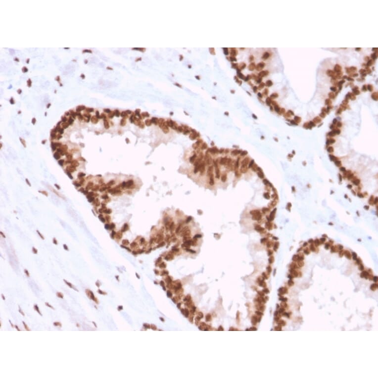 Immunohistochemistry - Anti-APE1 Antibody [CPTC-APEX1-2] (A248871) - Antibodies.com