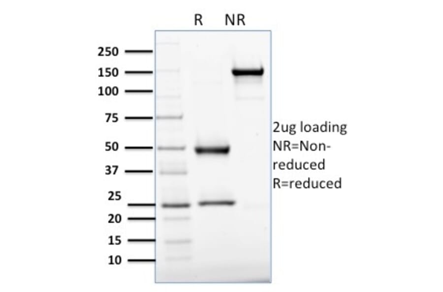 SDS-PAGE - Anti-APE1 Antibody [CPTC-APEX1-2] (A248871) - Antibodies.com