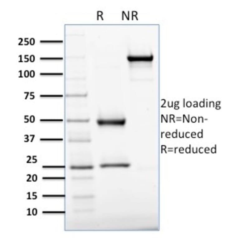 SDS-PAGE - Anti-APE1 Antibody [CPTC-APEX1-2] (A248871) - Antibodies.com