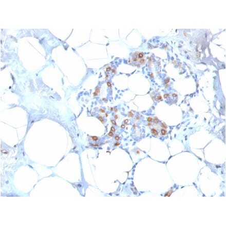 Immunohistochemistry - Anti-HSP27 Antibody [SPM252] (A248873) - Antibodies.com