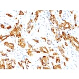 Immunohistochemistry - Anti-HSP27 Antibody [SPM252] (A248873) - Antibodies.com