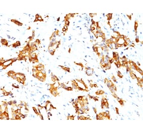 Immunohistochemistry - Anti-HSP27 Antibody [HSPB1/774] (A248874) - Antibodies.com