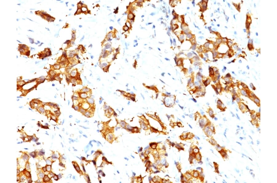Immunohistochemistry - Anti-HSP27 Antibody [HSPB1/774] (A248874) - Antibodies.com