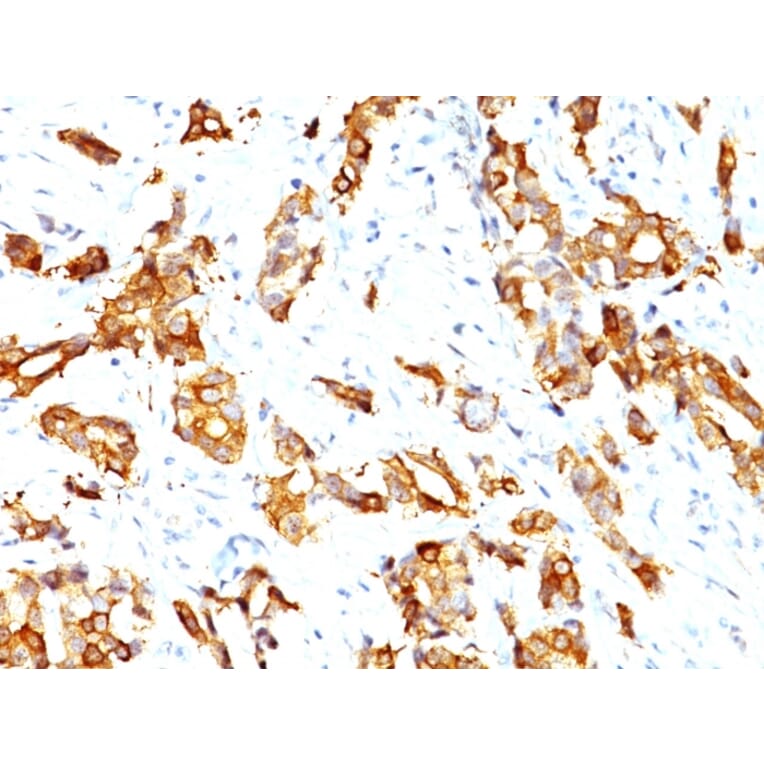 Immunohistochemistry - Anti-HSP27 Antibody [HSPB1/774] (A248874) - Antibodies.com