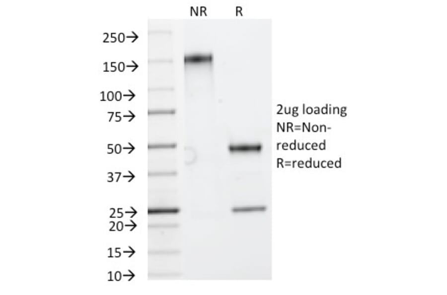 SDS-PAGE - Anti-HSP27 Antibody [HSPB1/774] (A248874) - Antibodies.com