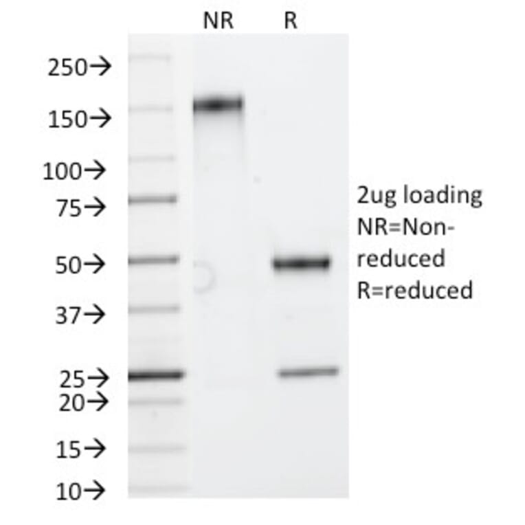 SDS-PAGE - Anti-HSP27 Antibody [HSPB1/774] (A248874) - Antibodies.com