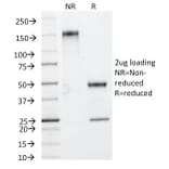 SDS-PAGE - Anti-HSP27 Antibody [HSPB1/774] (A248874) - Antibodies.com