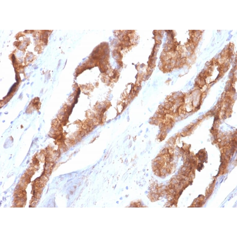 Immunohistochemistry - Anti-HSP27 Antibody [CPTC-HSPB1-2] (A248875) - Antibodies.com