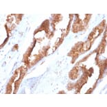 Immunohistochemistry - Anti-HSP27 Antibody [CPTC-HSPB1-2] (A248875) - Antibodies.com