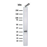 Western Blot - Anti-HSP27 Antibody [CPTC-HSPB1-2] (A248875) - Antibodies.com