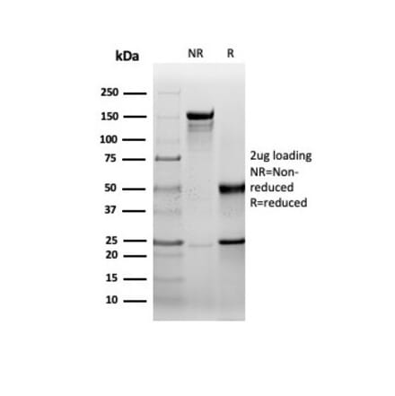 SDS-PAGE - Anti-HSP27 Antibody [rHSPB1/6489] (A248876) - Antibodies.com
