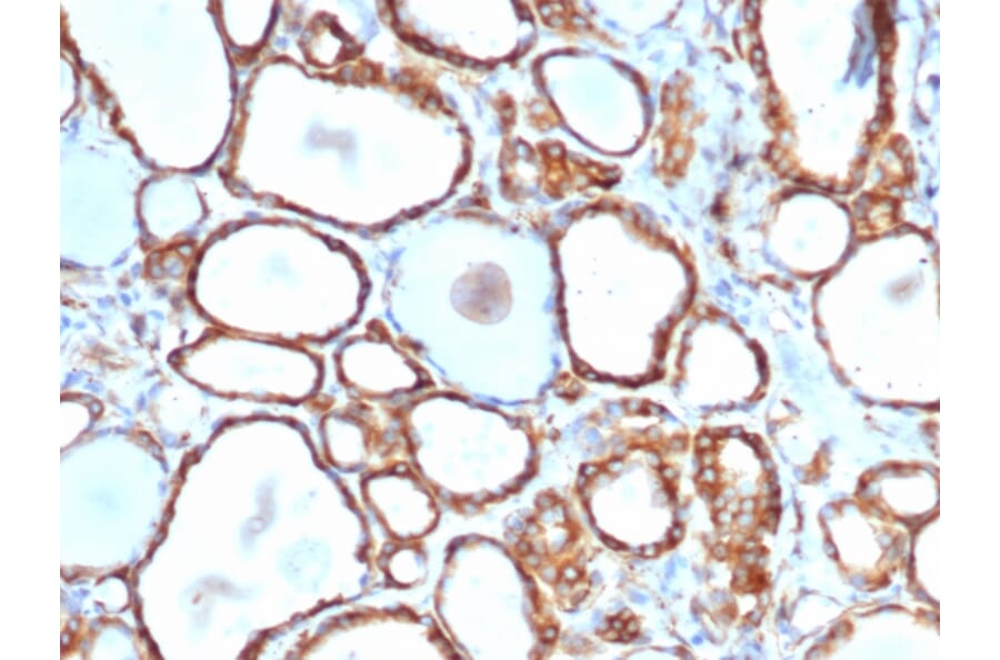Immunohistochemistry - Anti-HSP27 Antibody [rHSPB1/6489] (A248875) - Antibodies.com