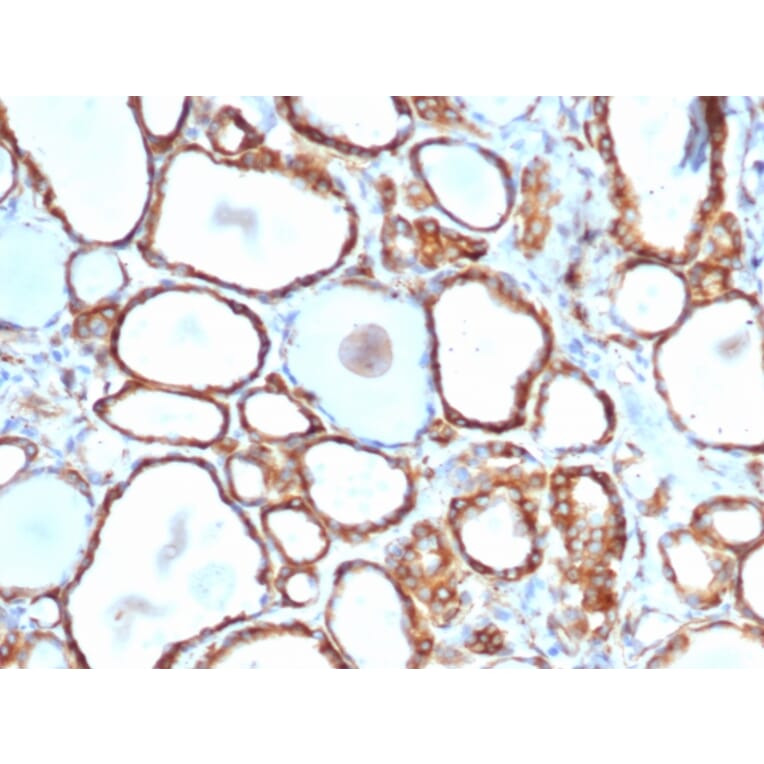 Immunohistochemistry - Anti-HSP27 Antibody [rHSPB1/6489] (A248875) - Antibodies.com