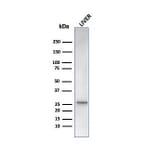 Western Blot - Anti-HSP27 Antibody [rHSPB1/6489] (A248876) - Antibodies.com