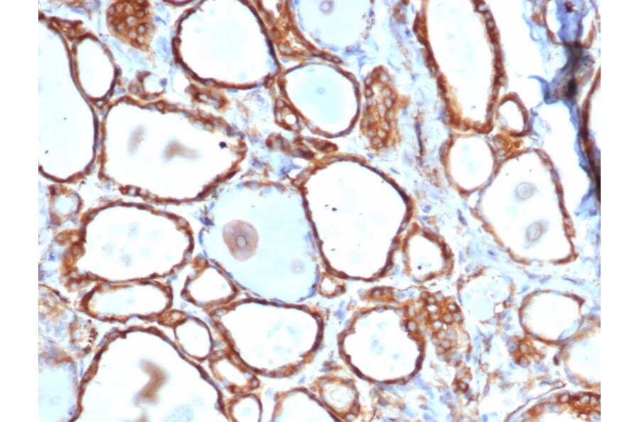 Immunohistochemistry - Anti-HSP27 Antibody [HSPB1/6490R] (A248876) - Antibodies.com