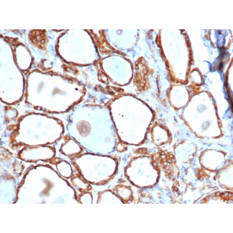 Immunohistochemistry - Anti-HSP27 Antibody [HSPB1/6490R] (A248876) - Antibodies.com